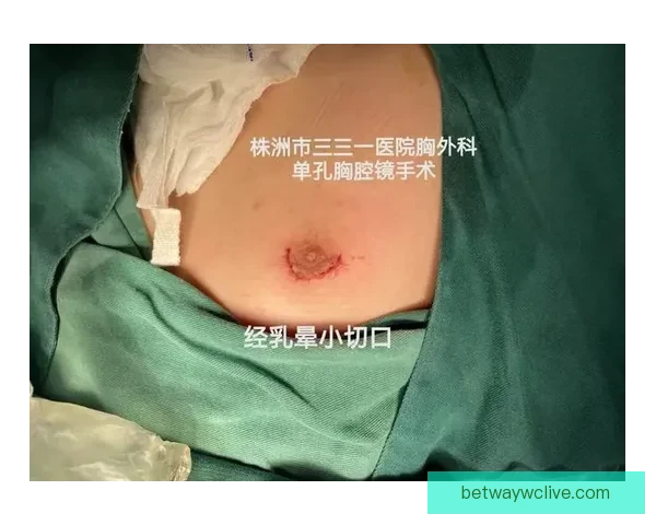 坎宁安气胸康复持续推进 活塞计划一周后复查评估